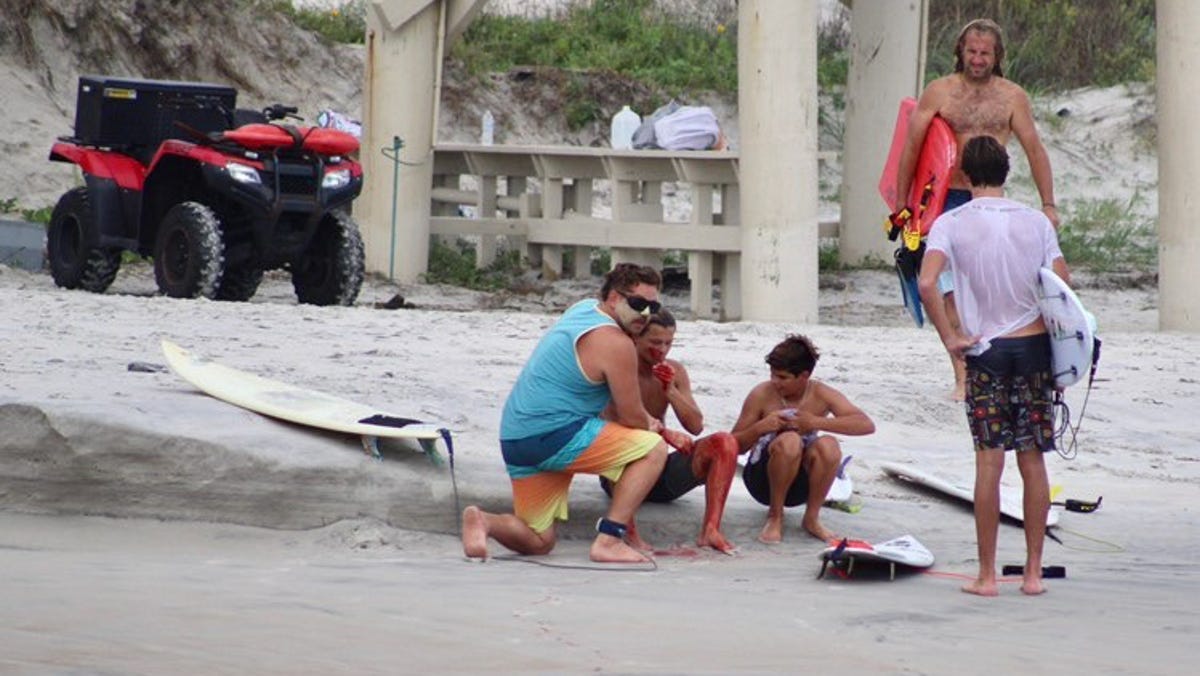 Volusia Beaches End The Year With 10 Shark Bites Officials Say