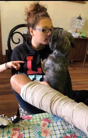 Isabella is consoled by her service dog, Zoey, after breaking her foot and ankle last year.