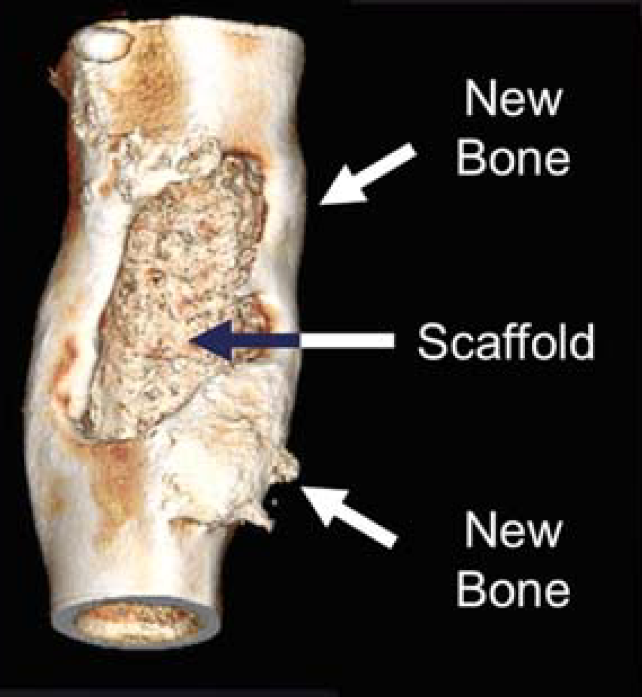 University of Arizona researchers saw new bone growth in sheep after implementing a stem cell treatment using a scaffolding technique.