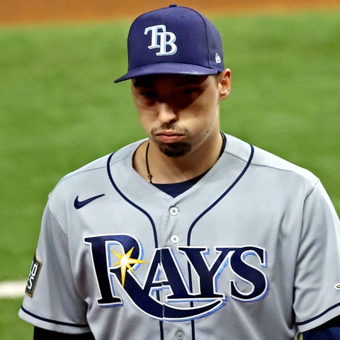 Blake Snell reacts as he's taken out of the game i