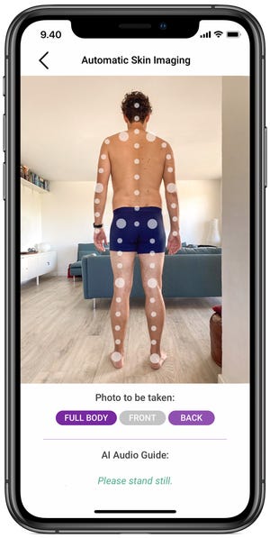 Automatic skin imaging by Miiskin app.