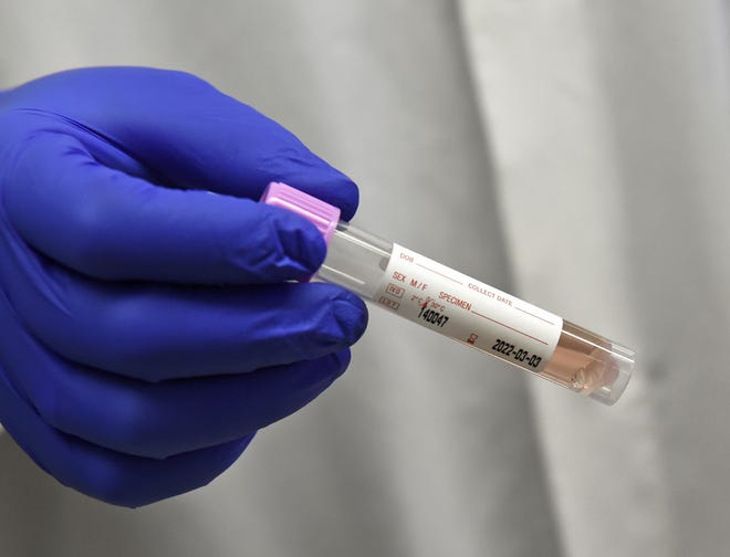 Four Washoe Residents Test Positive For Covid 19 Variant From India