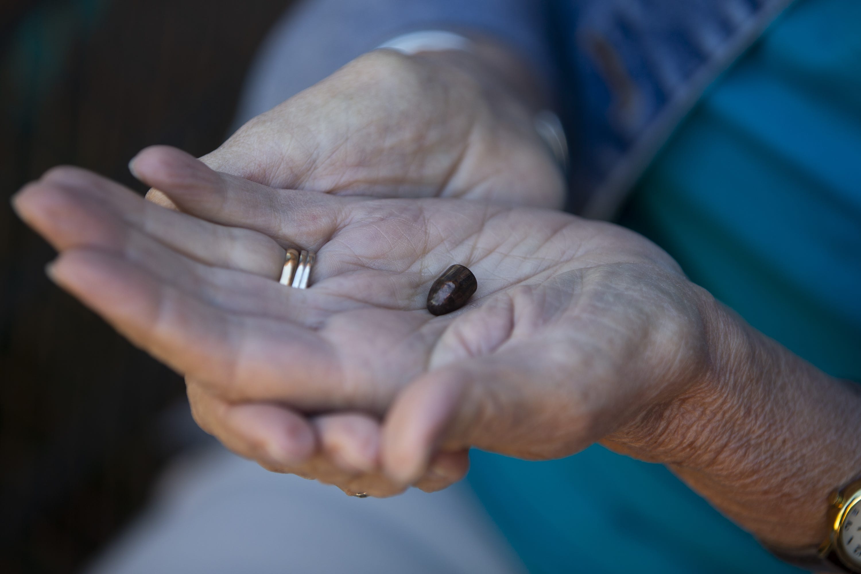 Pamela Simon holds the bullet that was removed from her body following the Jan. 8, 2011, mass shooting.