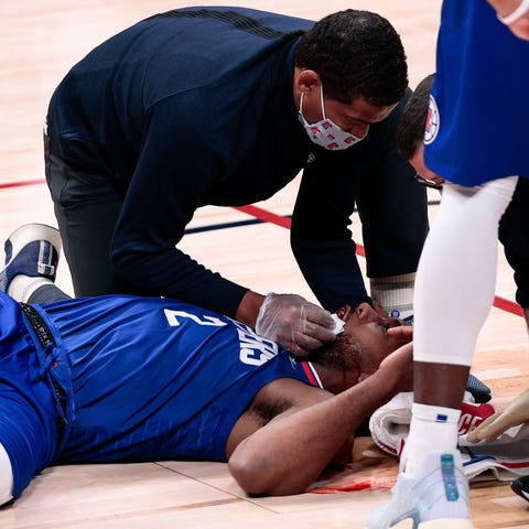 Trainers work to stop the bleeding from Kawhi Leon