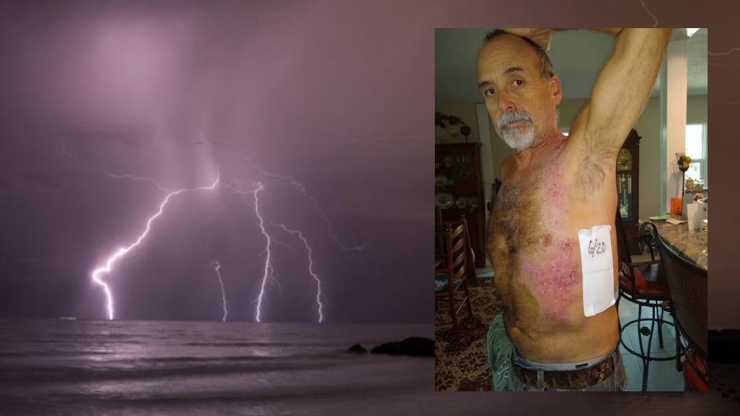 No pulse': Florida father, son live to tell miracle lightning tale