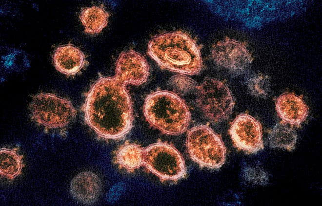 FILE - This 2020 electron microscope image provided by the National Institute of Allergy and Infectious Diseases - Rocky Mountain Laboratories shows SARS-CoV-2 virus particles which cause COVID-19, isolated from a patient in the U.S., emerging from the surface of cells cultured in a lab. Viruses are constantly mutating, with coronavirus variants circulating around the globe. (NIAID-RML via AP)