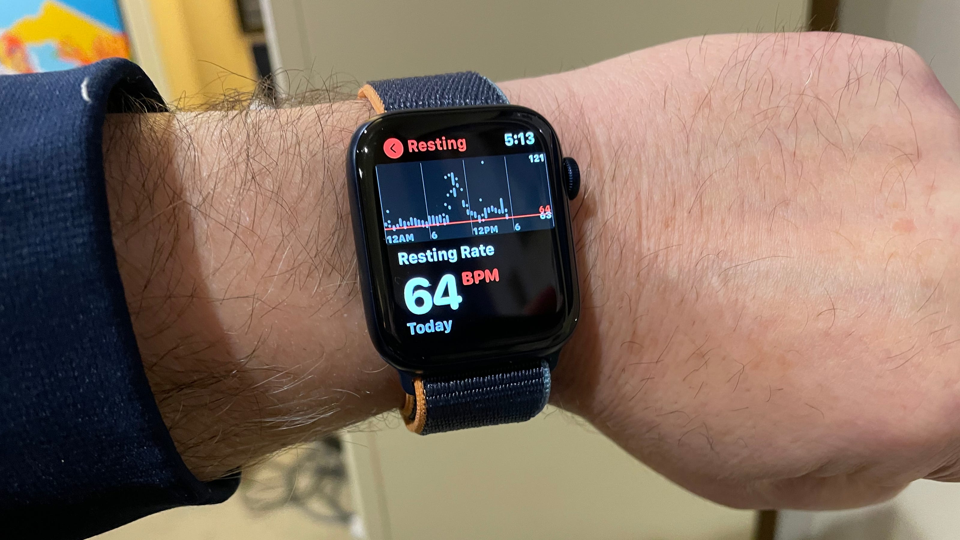 Apple Watch may track blood sugar levels, other health features