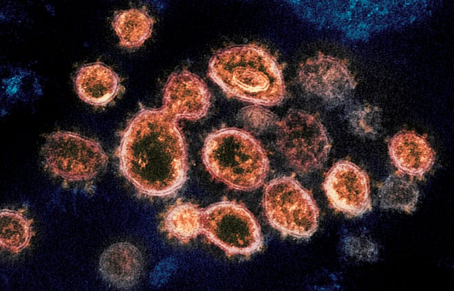 This 2020 electron microscope image provided by the National Institute of Allergy and Infectious Diseases - Rocky Mountain Laboratories shows SARS-CoV-2 virus particles which cause COVID-19, isolated from a patient in the U.S., emerging from the surface of cells cultured in a lab. Viruses are constantly mutating, with coronavirus variants circulating around the globe.