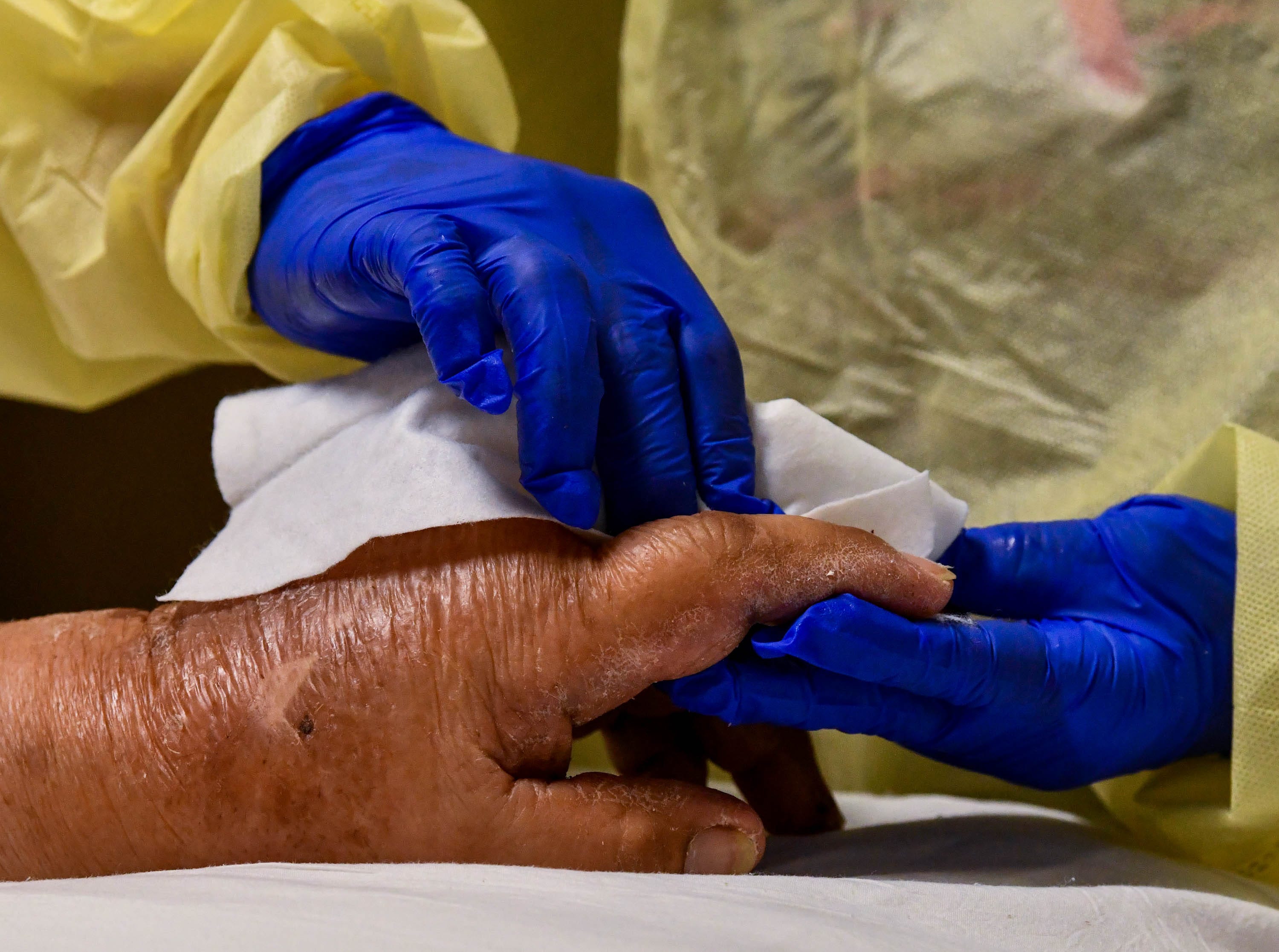 A nurse wipes down a COVID-19 patient's hand on Tuesday, Feb. 9, 2021, at Providence Holy Cross Medical Center in Los Angeles.