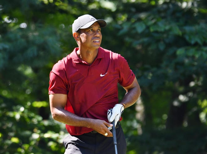 Tiger Woods suffered broken bones in his right leg that required surgery during a crash in February.