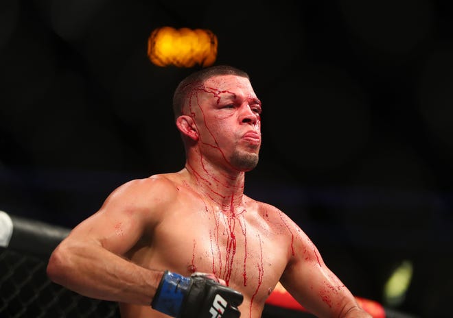 Nate Diaz reacts against Leon Edwards during UFC 263 at Gila River Arena. The Stockton native will fight Khamzat Chimaev on Sept. 10. It will be the last fight of Diaz's UFC contract.