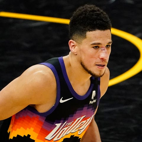 Suns guard Devin Booker (1) suffered a cut to his 