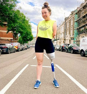 Jessica Ping-Wild has CHILD syndrome, a rare condition that causes underdevelopment or lack of limbs. In this Disability Pride Month, she focuses on amplifying the voices of people with disabilities.