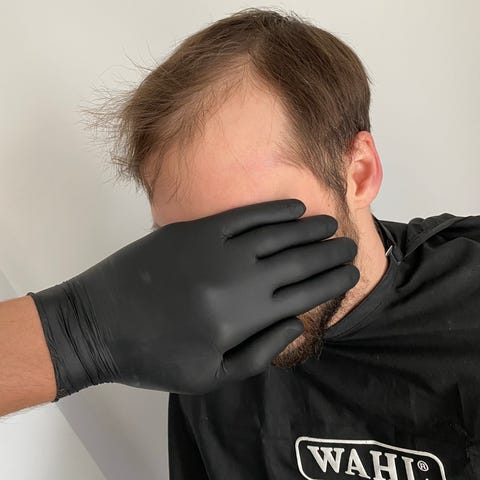 A before shot of a client at Hair Repair Club
