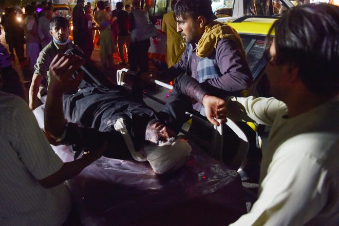 Medical and hospital staff bring an injured man on a stretcher for treatment after two blasts, which killed at least five and wounded a dozen, outside the airport in Kabul on August 26, 2021.