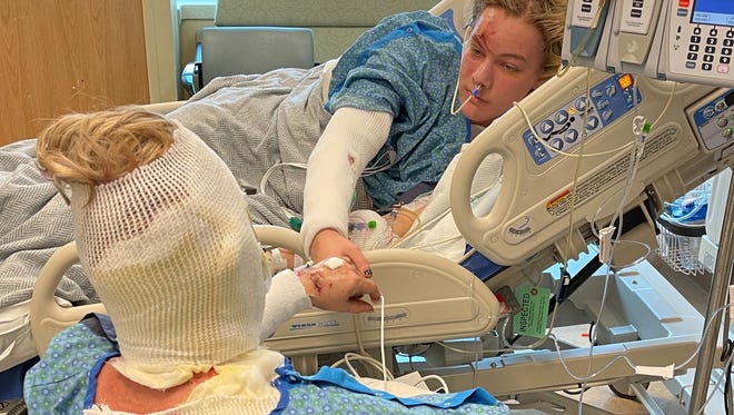 Logan Rico, right, holds the hand of his mother, Jody Rico, left, in an undated photo as they recover at the UCHealth Burn and Frostbite Center in Aurora, Colorado.