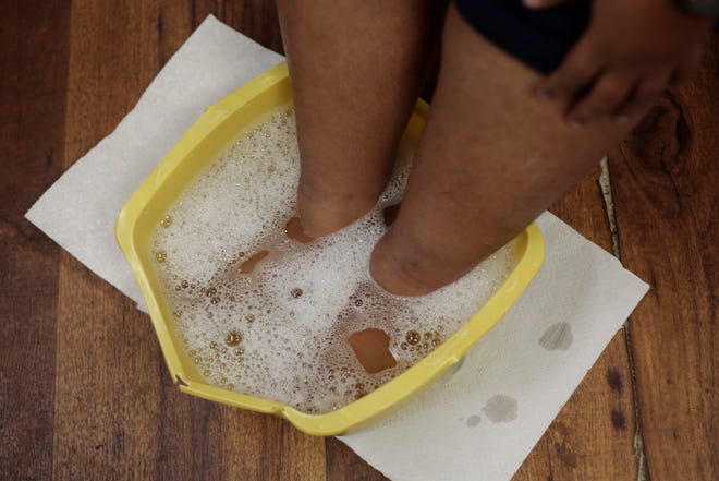 A woman soaks her feet in warm soapy water during the Mercy Meals podiatry clinic for homeless people at its facility on Purchase Street in New Bedford.