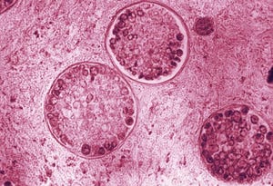 The fungus that causes Valley fever shown under a microscope in 1964. These round structures, known as spherules, evolve inside the host.