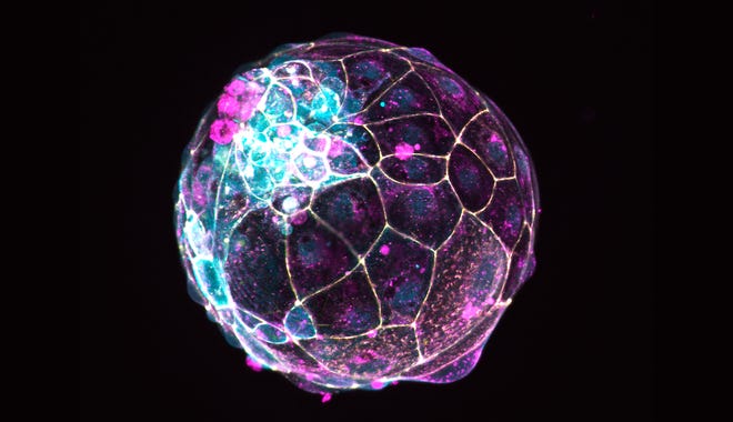 Ilmuwan menggunakan sel punca untuk membuat model pra-embrio