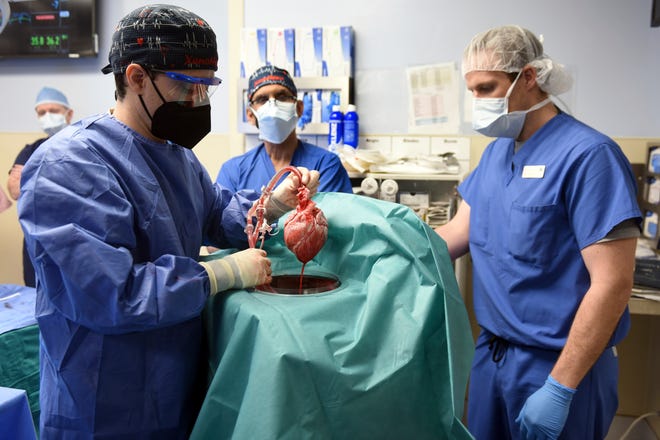 Pertama, ahli bedah AS mentransplantasikan jantung babi ke pasien manusia
