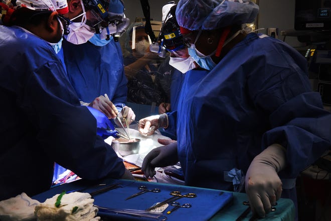 A surgical team at University of Maryland School of Medicine works to give patient Dave Bennett, 57 of Maryland, a gene-edited pig heart.