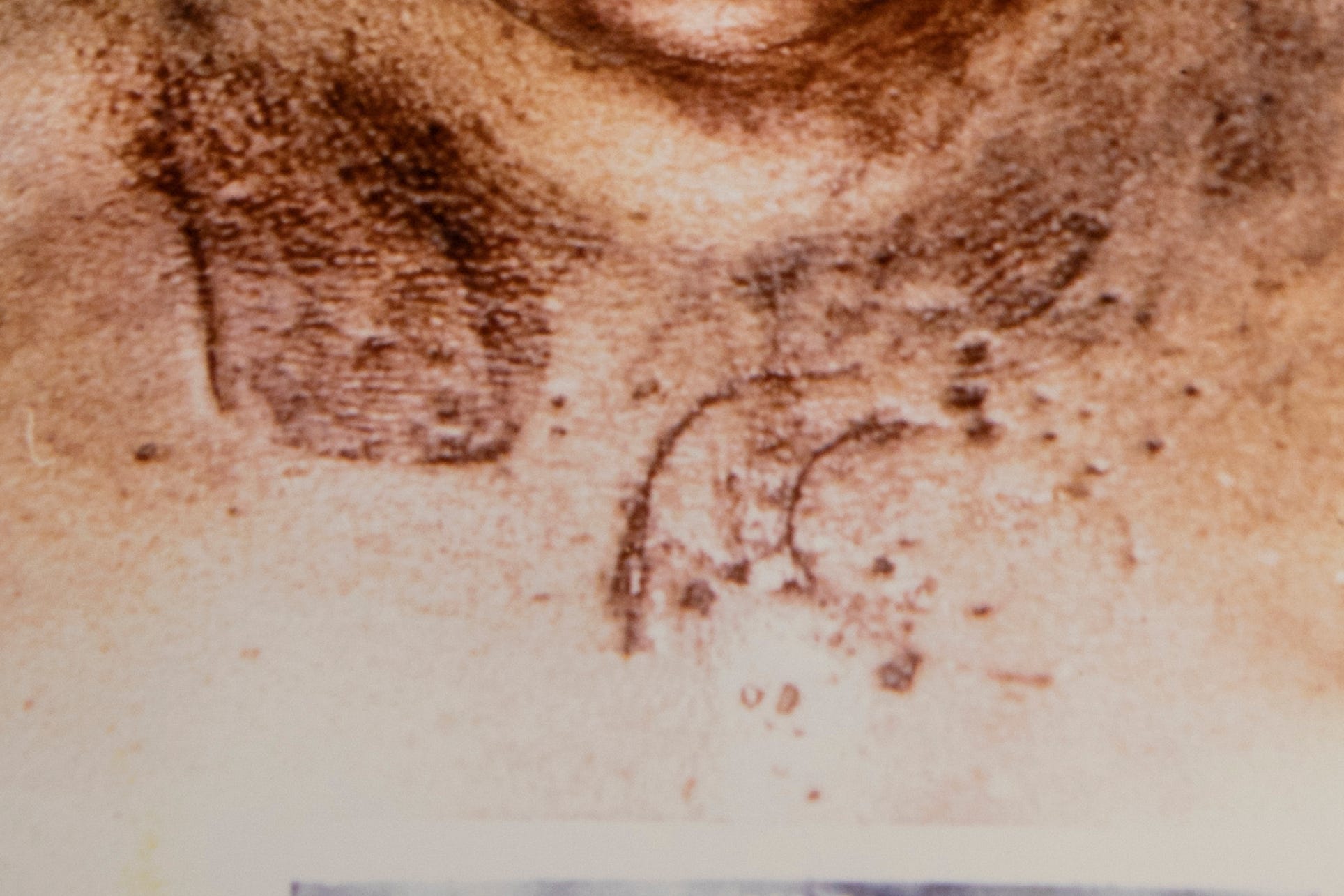 Evidence photos of Rhoda Nathan show bruises and markings from where she was beaten to death. Police argued that the markings could have been from Elwood Jones's walkie-talkie.