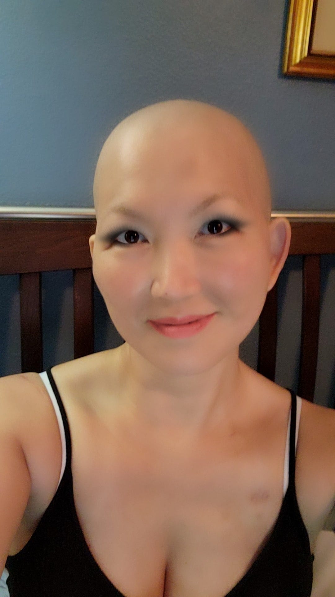 Black Widow Jeanette Lee one year after Stage 4 cancer diagnosis