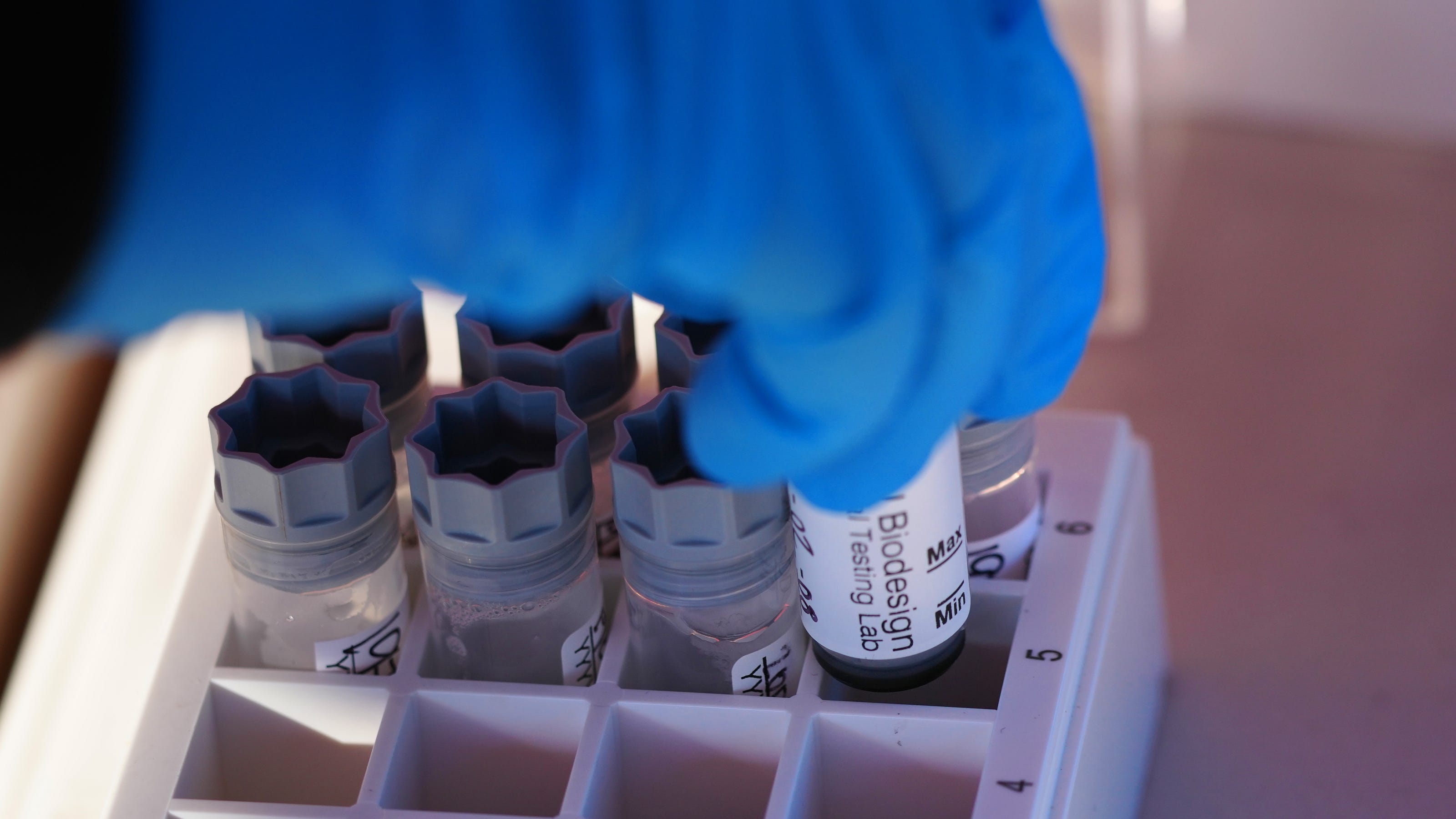 Arizona weekly COVID-19 update adds 16,334 cases, 28 deaths Arizona weekly COVID-19 update adds 16,334 cases, 28 deaths