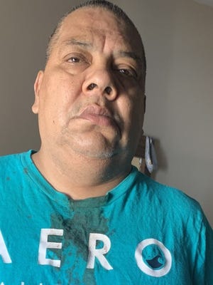 Patient suggests Milwaukee dentist extracted 13 teeth devoid of consent Patient suggests Milwaukee dentist extracted 13 teeth devoid of consent