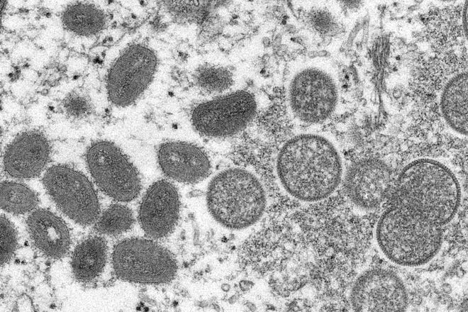 Gambar mikroskop elektron tahun 2003 yang disediakan oleh Pusat Pengendalian dan Pencegahan Penyakit ini menunjukkan virion monkeypox dewasa berbentuk oval, kiri, dan virion dewasa bulat, kanan, yang diperoleh dari sampel kulit manusia yang terkait dengan wabah anjing padang rumput 2003.
