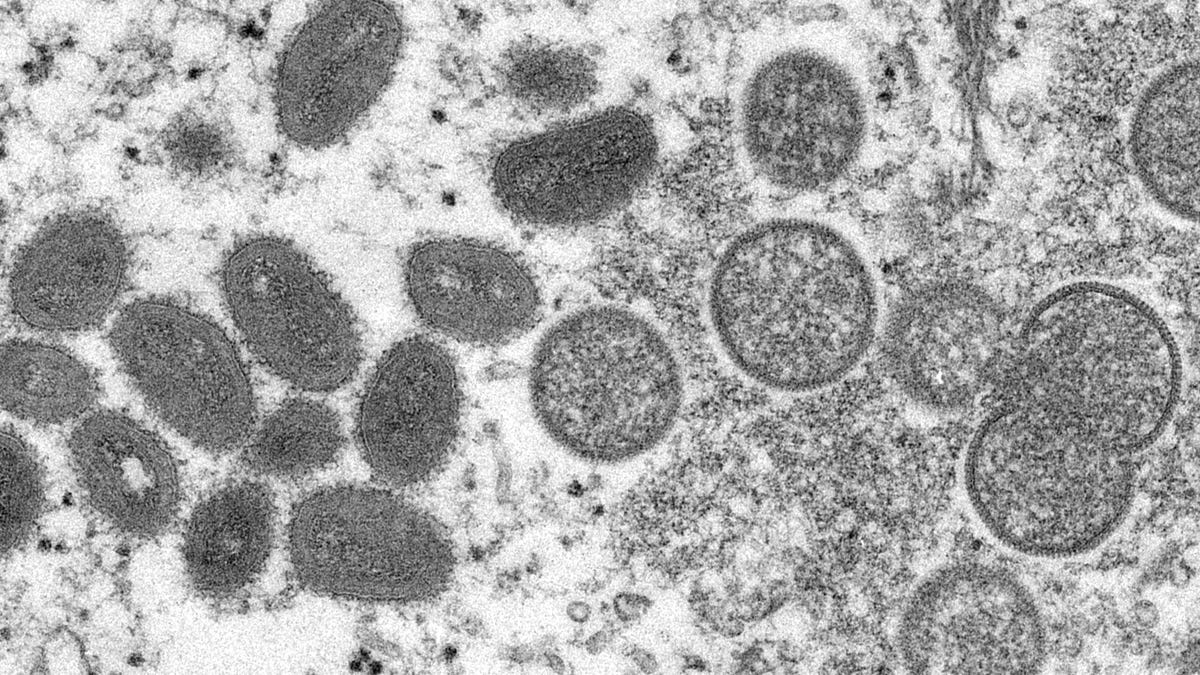This 2003 electron microscope image made available by the Centers for Disease Control and Prevention shows mature, oval-shaped monkeypox virions, left, and spherical immature virions, right, obtained from a sample of human skin associated with the 2003 prairie dog outbreak. Monkeypox, a disease that rarely appears outside Africa, has been identified by European and American health authorities in recent days. (Cynthia S. Goldsmith, Russell Regner/CDC via AP) ORG XMIT:   NY815
