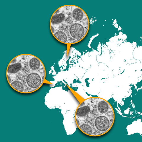 Closer look: Rare monkeypox cases around the world