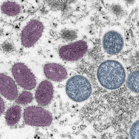 Monkeypox virus, colorized