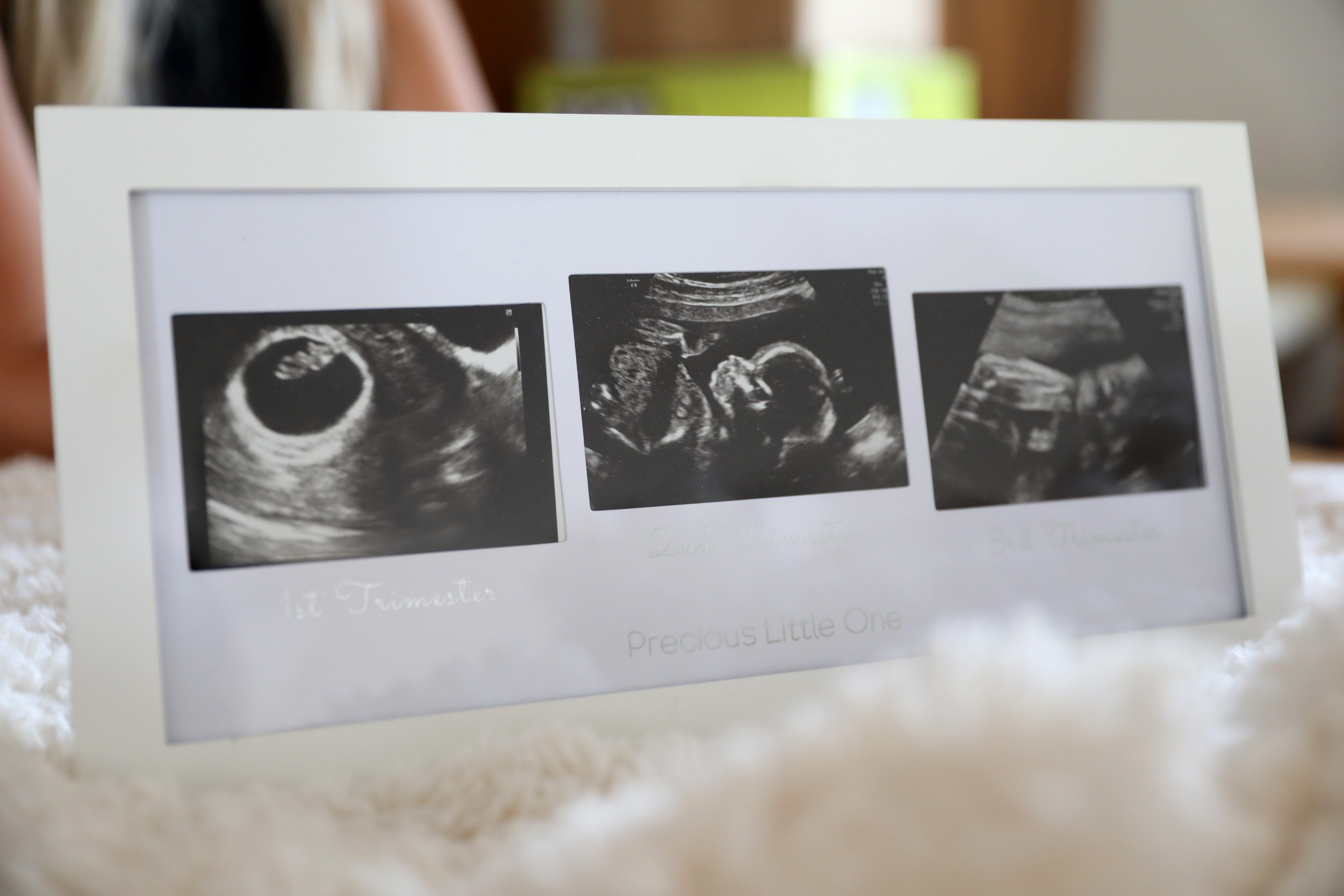 Sonograms of Cassidy Crough's daughter Olivia, who was born still in March, June 13, 2022 in New Milford, Conn. Crough is raising the alarm on New York's lack of paid leave for stillbirth moms. She gave birth to her deceased daughter Olivia in March, 2022 and under New York law, stillbirth moms don't qualify for the same paid family leave that new moms whose children live get.