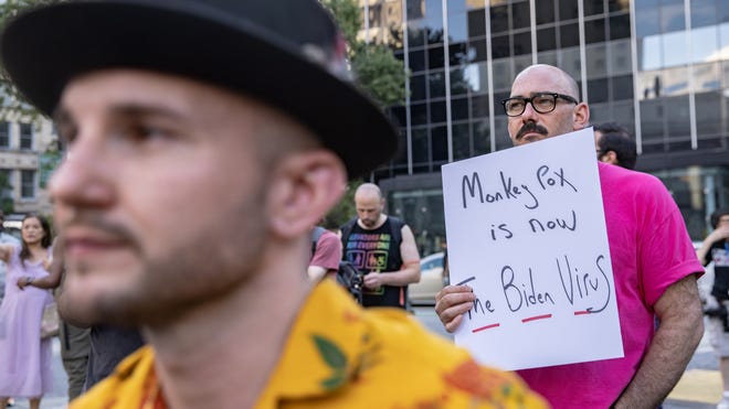 Monkeypox outbreak in US now world’s greatest after COVID-like errors Monkeypox outbreak in US now world’s greatest after COVID-like errors