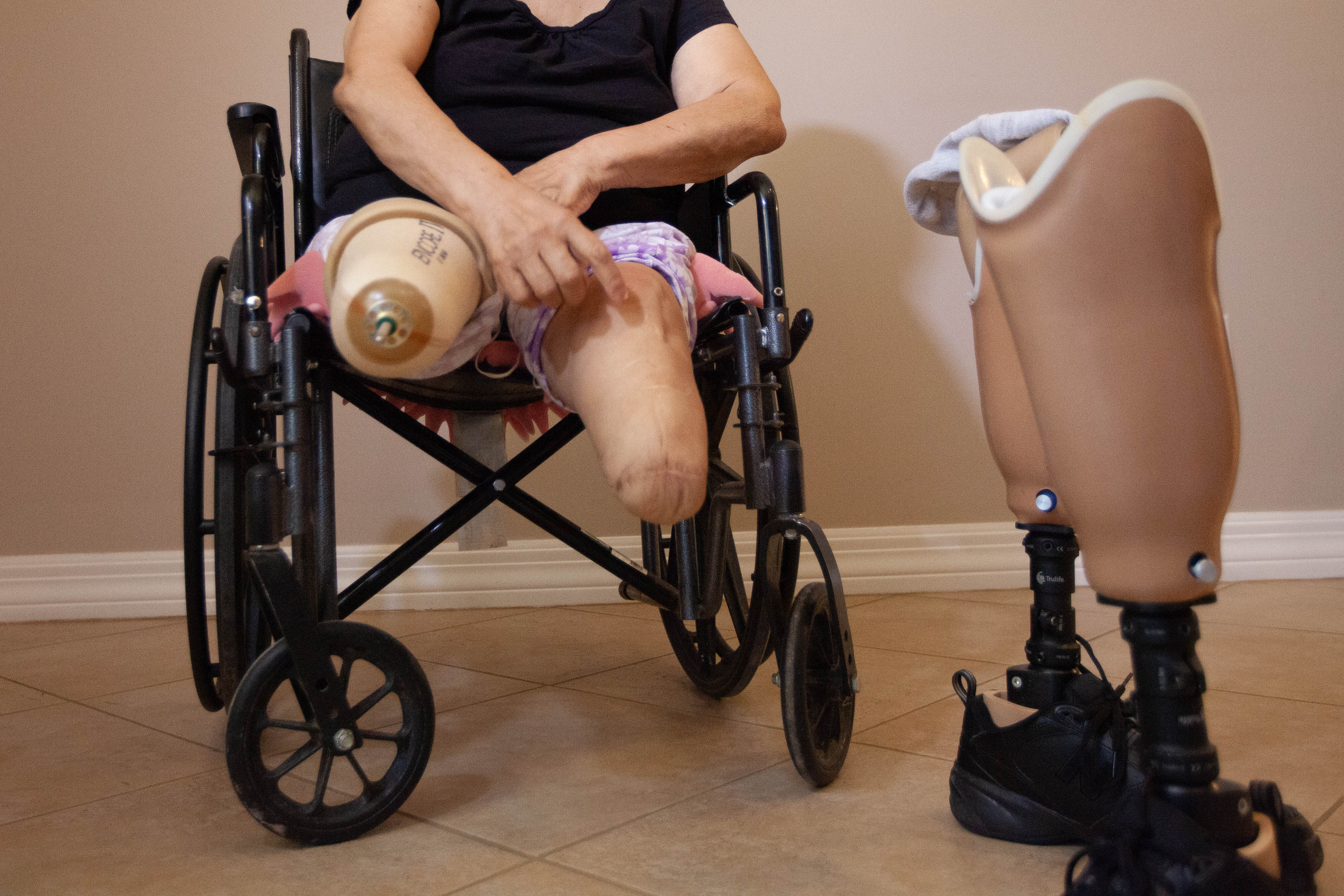 Victoria Garcia, 66, lost both legs after procedures at Modern Vascular.