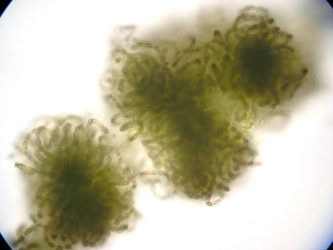 A microscope image of the cyanobacteria that form blue-green algae blooms in Lake Superior These cyanobacteria were collected in the waters near Meyers Beach on the Apostle Islands National Lakeshore
