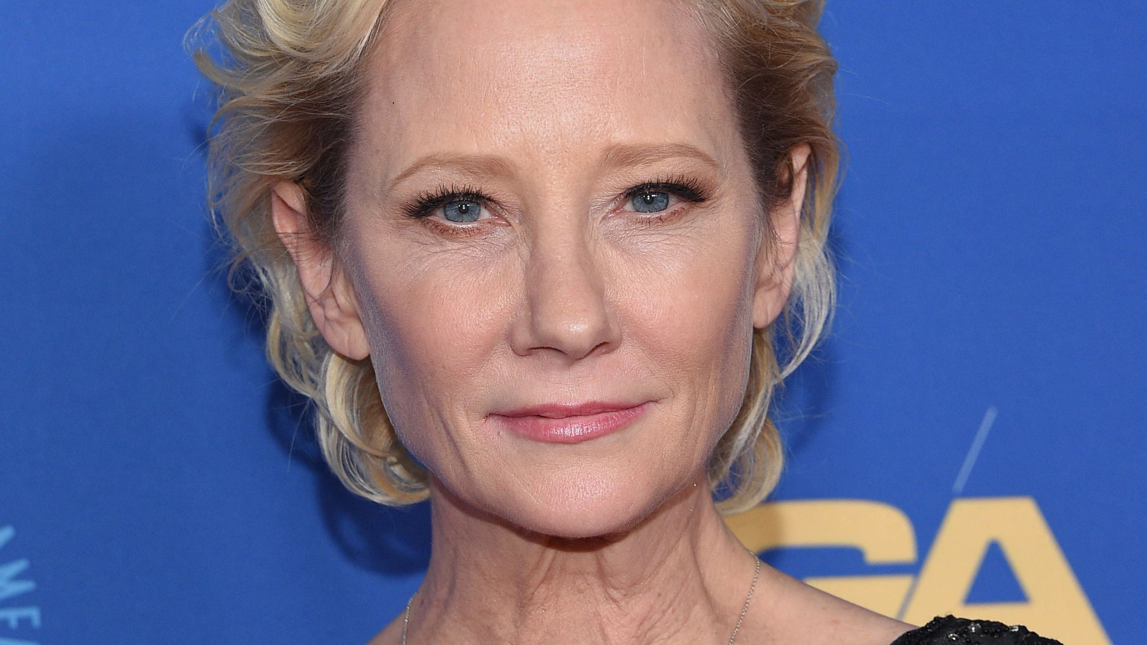 Anne Heche 'not expected to survive' following fiery car crash that left her in a coma