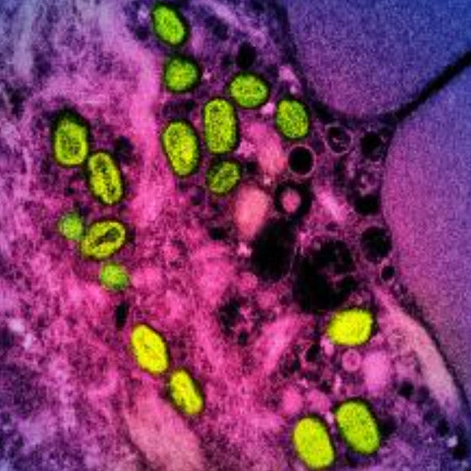 This image from the National Institute of Allergy and Infectious Diseases shows a colorized transmission electron micrograph of monkeypox particles (green) found within an infected cell (pink and purple) cultured in the laboratory.