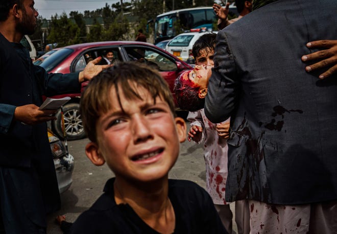 A child cries as a man carries a bloodied child on a road leading to an airport in Kabul, Afghanistan on Aug. 17, 2021.