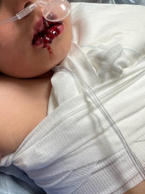 Connor Aranda, 8, is recovering after being violently attacked by a Labrador retriever at a home daycare in Apple Valley.