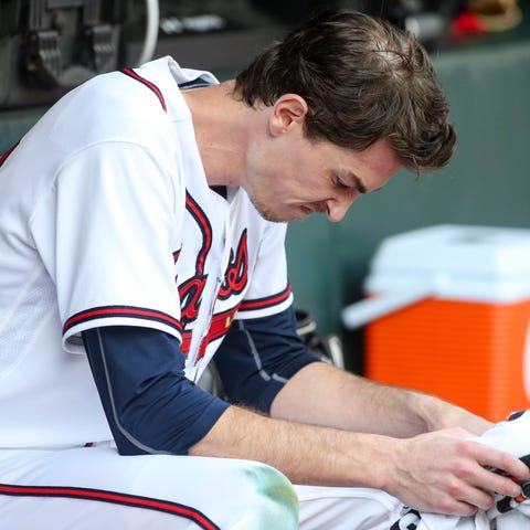 Game 1: Max Fried reacts after being removed from 
