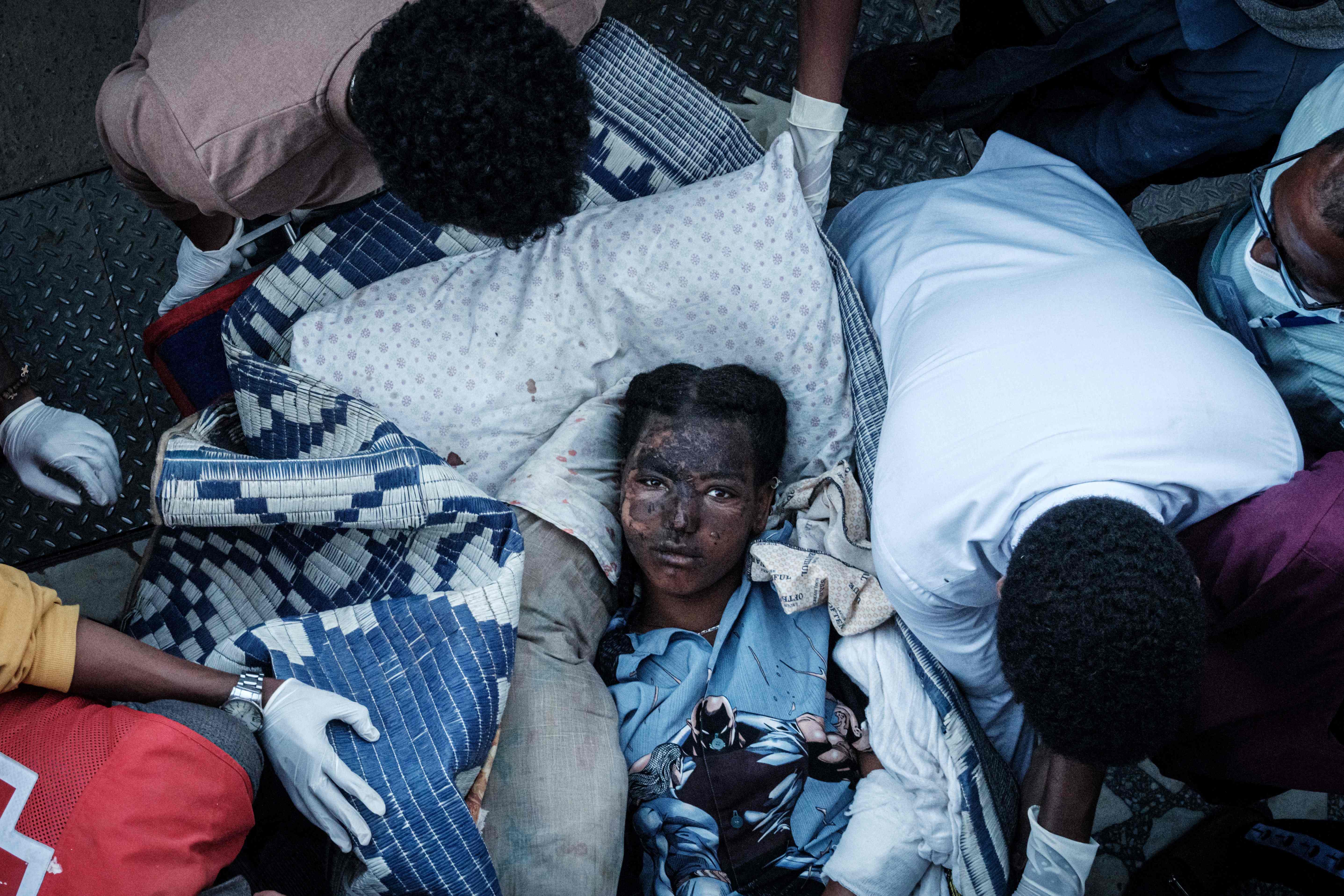 A wounded resident of Togoga, a village west of Mekele, arrives to the Ayder referral hospital in Mekele, the capital of the Tigray region in Ethiopia, a day after a deadly airstrike on a market.