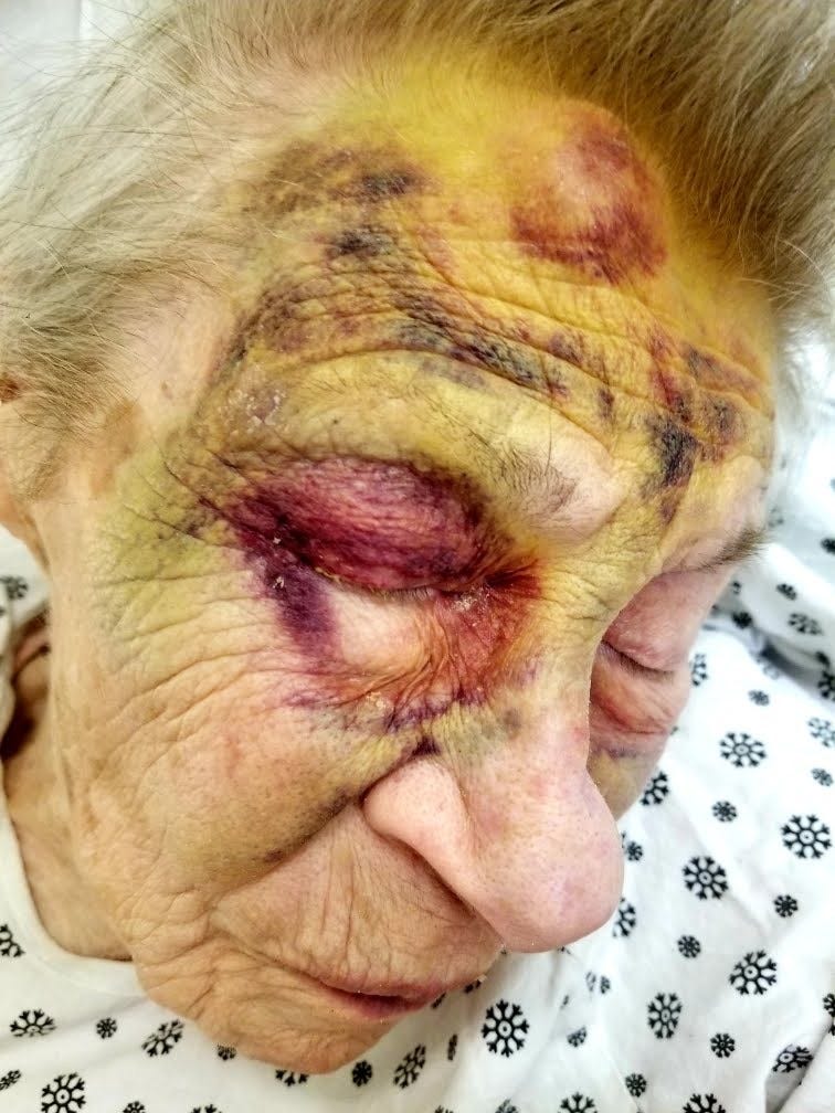 Grace Campbell lived in New York's Amsterdam Nursing Home until her death in January 2022 at the age of 98. Claire Campbell says her mother had multiple falls while a resident because of understaffing. Describing the photograph, she said: 