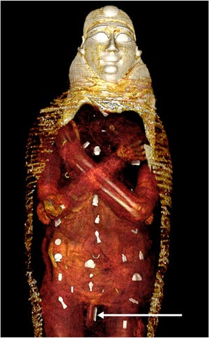 Three-dimensional computed tomography image of the front of the digitally unwrapped torso of a mummy, stored at the Cairo Egyptian Museum since 1916. The scans show the crossed arms position and amulets buried with the teen.