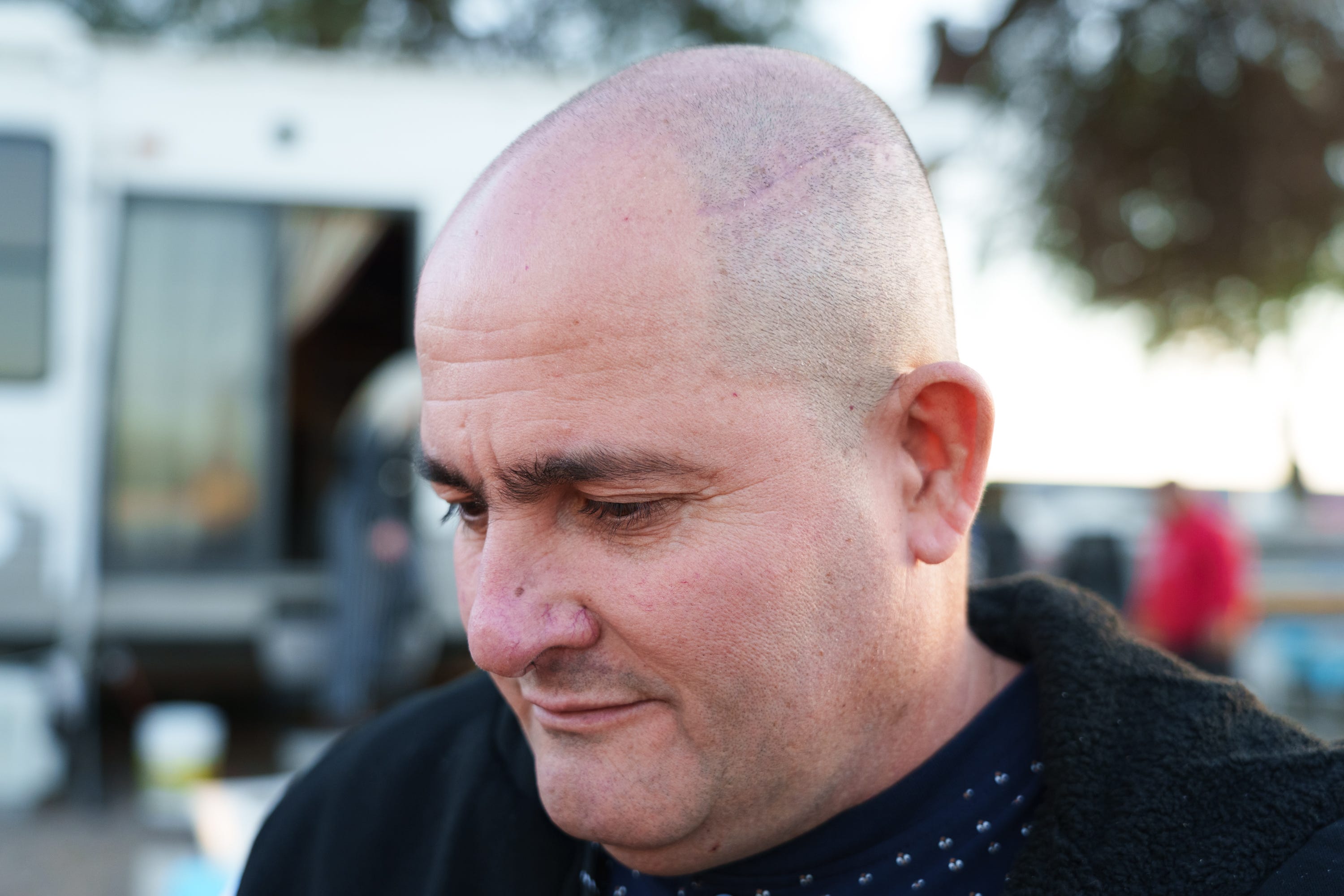 Eddy Córdova muestra la cicatriz es su cara, el 29 de enero de 2023 en Laveen.