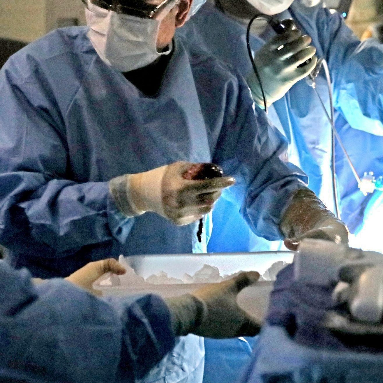 March is National Kidney Month. A transplant is used to treat kidney failure, a condition in which kidneys can function at only a fraction of their normal capacity. People with end-stage kidney disease need either dialysis or a kidney transplant to stay alive.