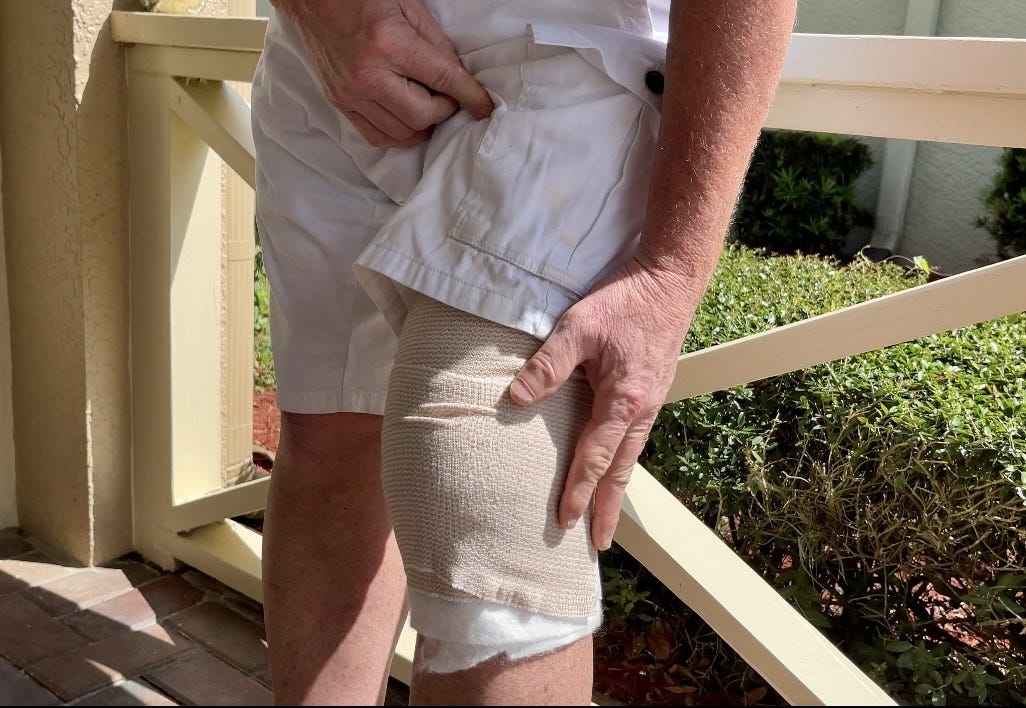 'A gator just bit me': An alligator attacked him on his front porch. Florida man shares his story.