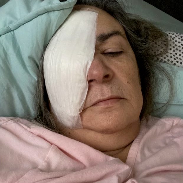 Doctors removed Clara Oliva's eye in September