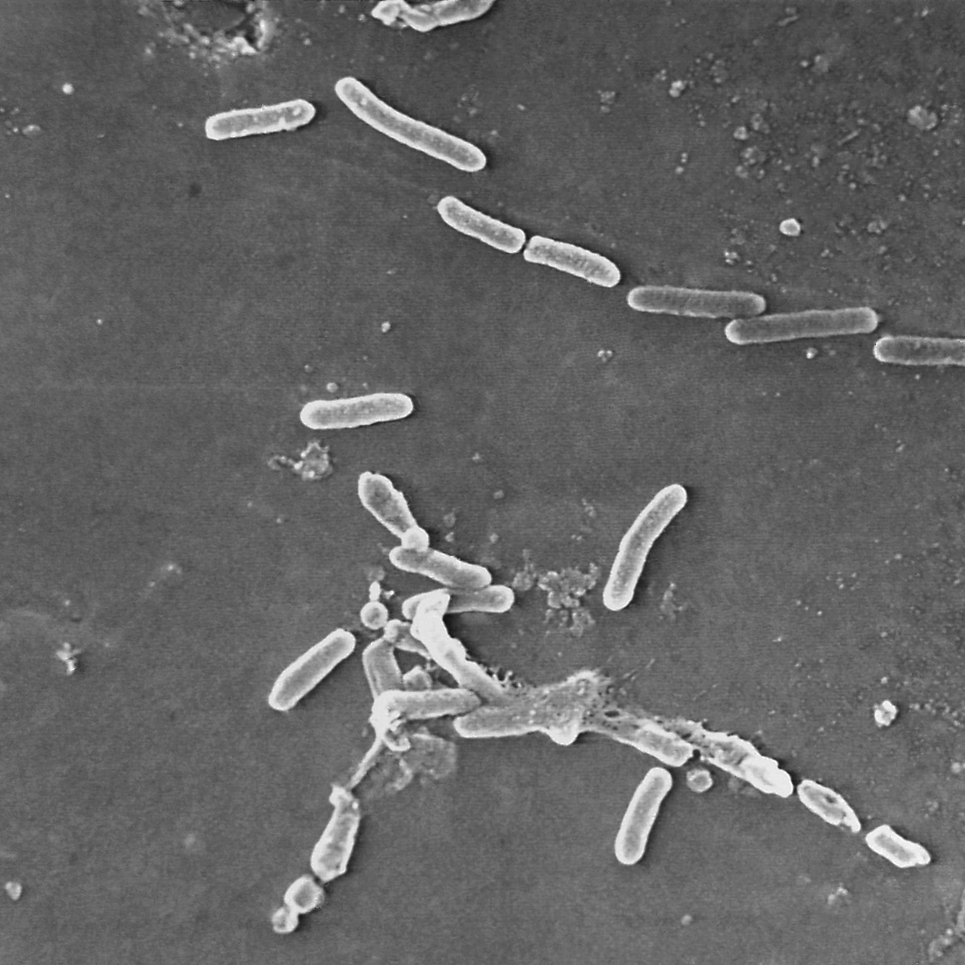 This scanning electron microscope image made available by The Centers for Disease Control and Prevention shows rod-shaped Pseudomonas aeruginosa bacteria. U.S. officials are reporting two more deaths and additional cases of vision loss linked to eyedrops tainted with the drug-resistant bacteria. The eyedrops from EzriCare and Delsam Phama were recalled in February 2023 and health authorities are tracking infections as they investigate the outbreak.